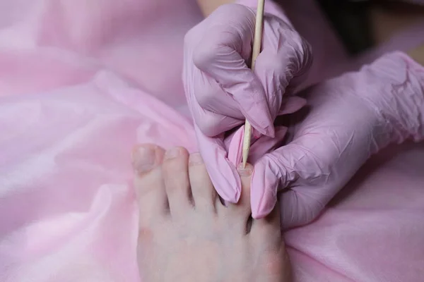 Een Patiënt Die Een Medische Pedicure Ondergaat Bij Een Orthopedische — Stockfoto