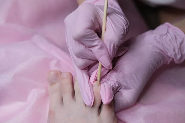 Een Patiënt Die Een Medische Pedicure Ondergaat Bij Een Orthopedische — Stockfoto