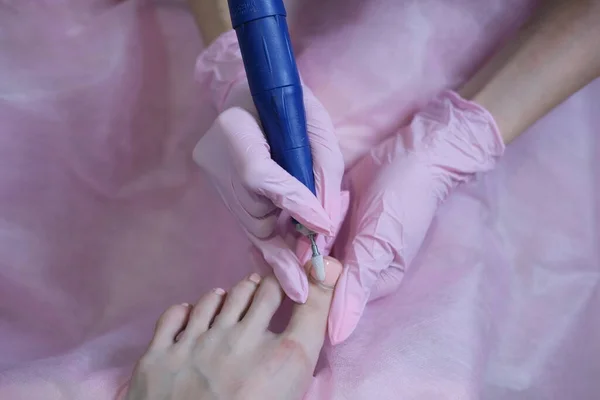 Patient Undergoing Medical Pedicure Procedure Orthopedic Surgeon Appointment Professional Hardware — Stock Photo, Image