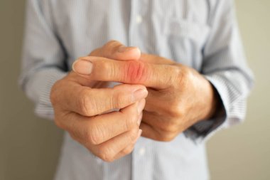Senior man suffering from hand and finger joint pain with redness. Cause of pain include rheumatoid arthritis, carpal tunnel syndrome, trigger finger or gout. Health care and medical. clipart