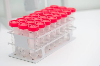 Laboratuvarda bir grup plastik test tüpü.. 