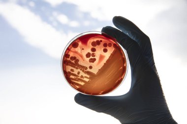 Mikrobiyoloji laboratuvarında tarım ortamında büyüyen bakteriler. Beyaz arka planda izole edilmiş bir petri kabında iz bırakmak. Petri kabında bakteri kolonilerinin karışımı..