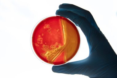Mikrobiyoloji laboratuvarında tarım ortamında büyüyen bakteriler. Beyaz arka planda izole edilmiş bir petri kabında iz bırakmak. Petri kabında bakteri kolonilerinin karışımı..