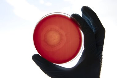 Mikrobiyoloji laboratuvarında tarım ortamında büyüyen bakteriler. Beyaz arka planda izole edilmiş bir petri kabında iz bırakmak. Petri kabında bakteri kolonilerinin karışımı..