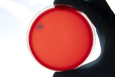 Mikrobiyoloji laboratuvarında tarım ortamında büyüyen bakteriler. Beyaz arka planda izole edilmiş bir petri kabında iz bırakmak. Petri kabında bakteri kolonilerinin karışımı..