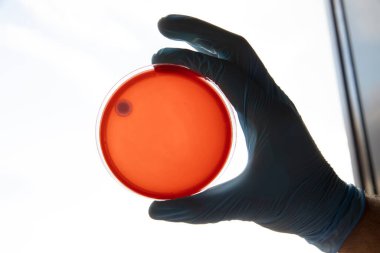 Mikrobiyoloji laboratuvarında tarım ortamında büyüyen bakteriler. Beyaz arka planda izole edilmiş bir petri kabında iz bırakmak. Petri kabında bakteri kolonilerinin karışımı..