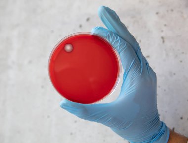 Mikrobiyoloji laboratuvarında tarım ortamında büyüyen bakteriler. Beyaz arka planda izole edilmiş bir petri kabında iz bırakmak. Petri kabında bakteri kolonilerinin karışımı..