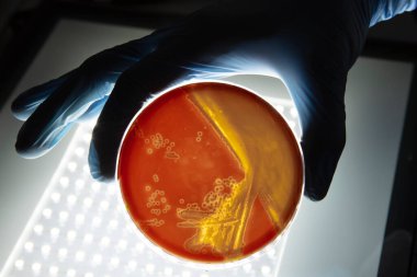 Mikrobiyoloji laboratuvarında tarım ortamında büyüyen bakteriler. Beyaz arka planda izole edilmiş bir petri kabında iz bırakmak. Petri kabında bakteri kolonilerinin karışımı..