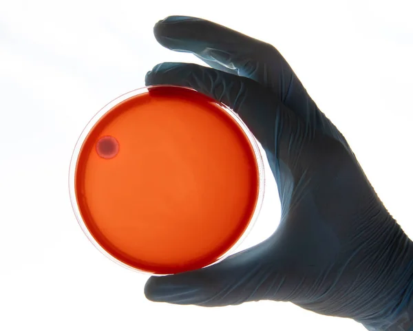 微生物学实验室琼脂培养基中的细菌培养 在白色背景上隔离的培养皿中做条纹 培养皿中细菌菌落的混合 — 图库照片