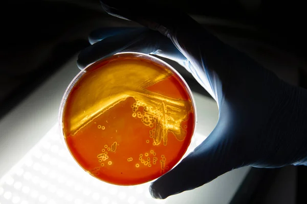 Hodowla Bakterii Podłożu Agarowym Laboratorium Mikrobiologicznym Dokonywanie Smugi Szalce Petriego — Zdjęcie stockowe
