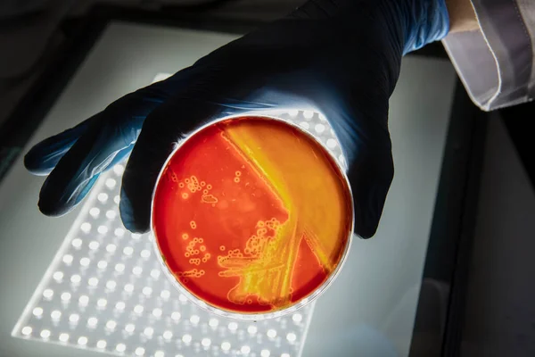 Καλλιέργεια Βακτηρίων Άγαρ Στο Εργαστήριο Μικροβιολογίας Κάνοντας Σερί Ένα Τρυβλίο — Φωτογραφία Αρχείου