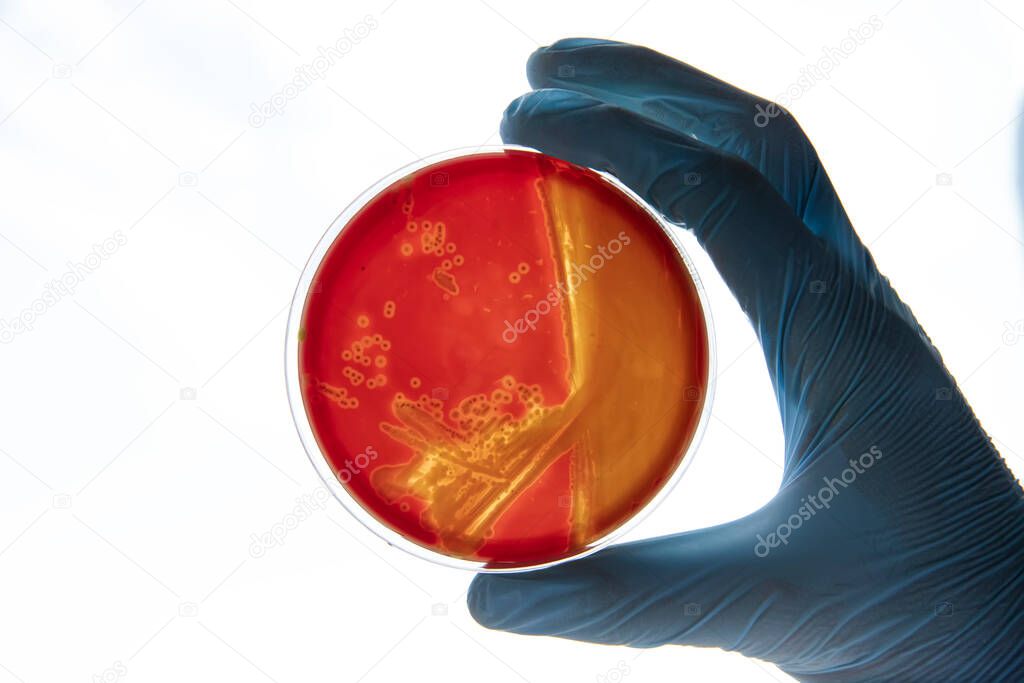 Growing bacteria in agar medium in microbiology lab. Making streak in a petri dish isolated on white background. Mixed of bacteria colonies in petri dish.