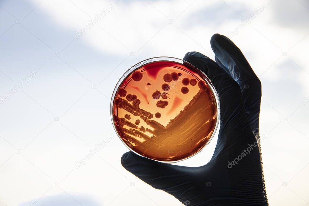 Growing bacteria in agar medium in microbiology lab. Making streak in a petri dish isolated on white background. Mixed of bacteria colonies in petri dish.