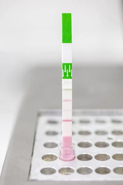 用于检测动物乳中的抑制剂和抗生素的系统 牛奶抗生素测试 兽医正在实验室里做一个测试 — 图库照片