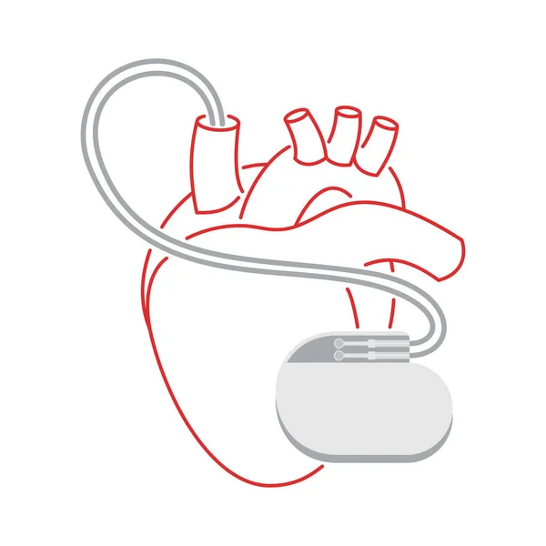 Pacemaker - impianto cardio umano in linea sottile — Vettoriale Stock