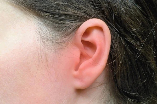 Ženské Ucho Červenými Znaky Zánětu Zdravotní Problém — Stock fotografie