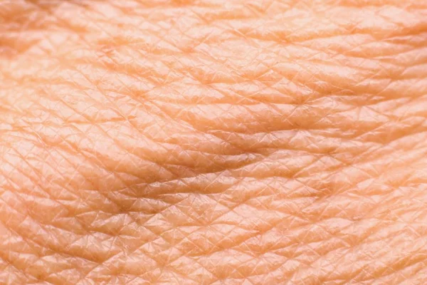 Detailní Textura Stárnoucí Suché Lidské Kůže — Stock fotografie