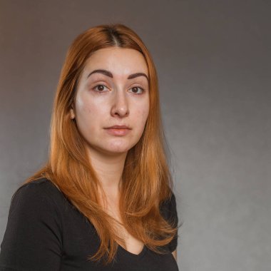 Deri döküntülerine, sivilcelere, akne yaralarına, sağlıklı cilt konseptine, dermatolojiye ve kozmetolojiye eğilimli.