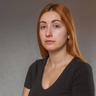 Deri döküntülerine, sivilcelere, akne yaralarına, sağlıklı cilt konseptine, dermatolojiye ve kozmetolojiye eğilimli.