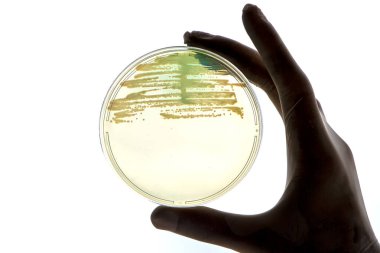 Bakteriyel enfeksiyon için laboratuvar teknisyeni testleri bakteri kolonileri büyüyen laboratuvar çalışanının elinde Petri kapları tıp hastanesi araştırmaları salgın kontrol önleme testleri var.