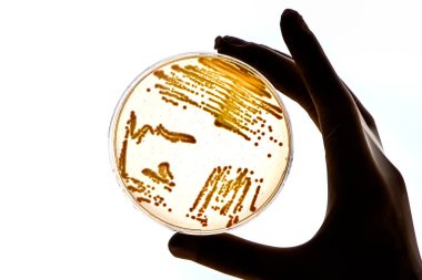 Bakteriyel enfeksiyon için laboratuvar teknisyeni testleri bakteri kolonileri büyüyen laboratuvar çalışanının elinde Petri kapları tıp hastanesi araştırmaları salgın kontrol önleme testleri var.