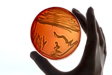 Bakteriyel enfeksiyon için laboratuvar teknisyeni testleri bakteri kolonileri büyüyen laboratuvar çalışanının elinde Petri kapları tıp hastanesi araştırmaları salgın kontrol önleme testleri var.