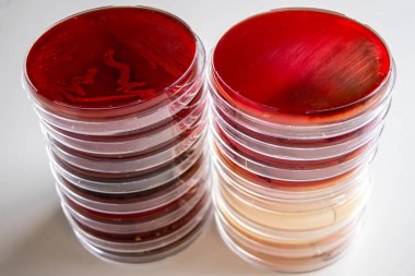 Mikrobiyoloji laboratuvar masasında bir yığın petri kabı.