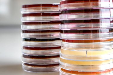 Mikrobiyoloji laboratuvar masasında bir yığın petri kabı.