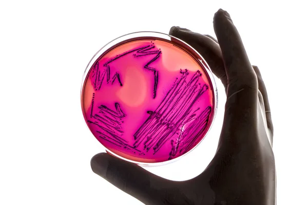 Laboratorium Technicus Tests Voor Bacteriële Infectie Analyseert Bacteriële Kolonies Groei — Stockfoto