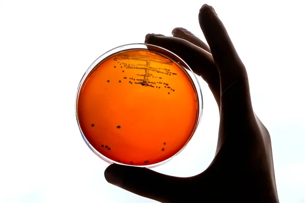 細菌感染のための実験室技術者のテストは 細菌コロニーの成長を分析します研究室の労働者の手は ペトリ皿のテストサンプルを保持しています医学病院の研究感染症制御予防 — ストック写真