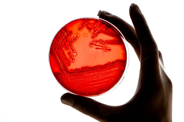 Testes Técnicos Laboratório Para Infecção Bacteriana Analisa Crescimento Colônias Bacterianas Fotografia De Stock