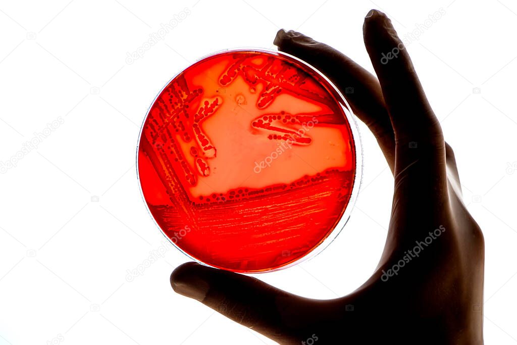 Laboratory technician tests for bacterial infection analyzes bacterial colonies growth Lab worker's hand holds test sample in Petri dishes Medical hospital research Disease outbreak control prevention