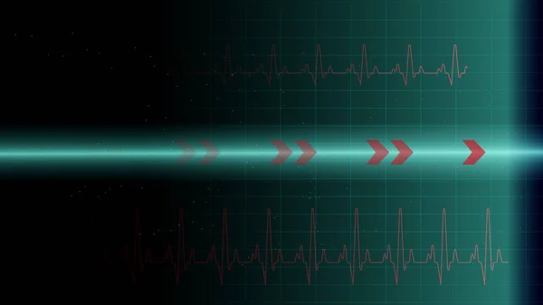 Tec Arayüzü Için Kalp Atışı Veya Ekg Ekranda Parlayan Parçacıklar — Stok Vektör