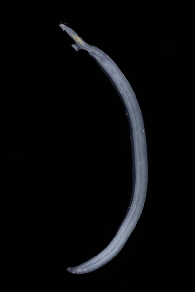 Şistozom Schistosoma Laboratuvar Ortamında Eğitim Için Mikroskop Altında Yaygın Olarak — Stok fotoğraf