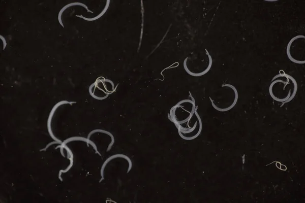 Schistosoma Género Trematodos Comúnmente Conocido Como Grietas Sanguíneas Bajo Microscopio — Foto de Stock