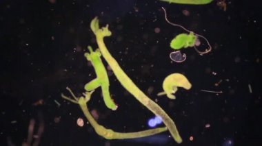 Hydra, Cnidaria cinsi ve Hydrozoa sınıfı eğitim için mikroskop altında bulunan küçük, tatlı su hayvanlarından oluşan bir cinstir..