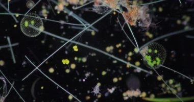 Volvox, sınıf eğitimi için mikroskop altında su damlasında.