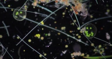 Volvox, sınıf eğitimi için mikroskop altında su damlasında.