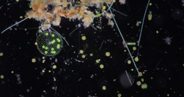 Volvox, sınıf eğitimi için mikroskop altında su damlasında.