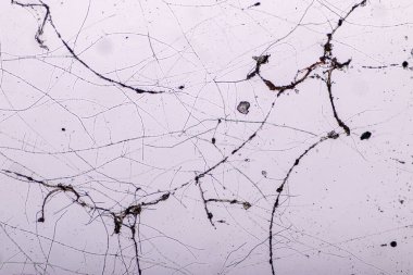  Rhizopus 'un özellikleri, eğitim için mikroskop altında kayan yaygın bir safirik mantar cinsidir..