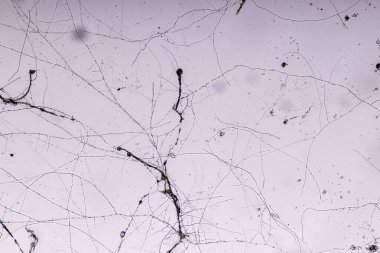  Rhizopus 'un özellikleri, eğitim için mikroskop altında kayan yaygın bir safirik mantar cinsidir..