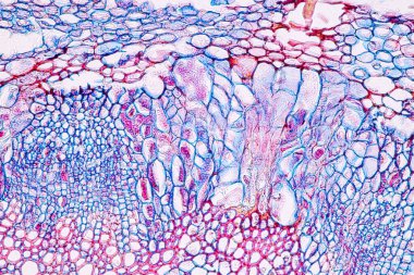 Zygomycota, or zygote fungi ,Downy mildew of cruzifers host tissue with conidia living in decaying plant on Slide under the microscope for education. clipart