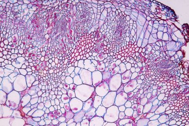 Zygomycota, or zygote fungi ,Downy mildew of cruzifers host tissue with conidia living in decaying plant on Slide under the microscope for education. clipart