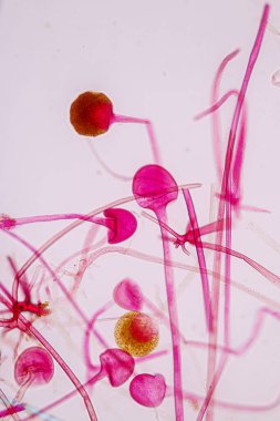  Rhizopus 'un özellikleri, eğitim için mikroskop altında kayan yaygın bir safirik mantar cinsidir..