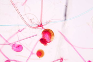  Rhizopus 'un özellikleri, eğitim için mikroskop altında kayan yaygın bir safirik mantar cinsidir..