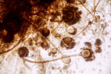  Rhizopus 'un özellikleri, eğitim için mikroskop altında kayan yaygın bir safirik mantar cinsidir..