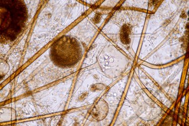  Rhizopus 'un özellikleri, eğitim için mikroskop altında kayan yaygın bir safirik mantar cinsidir..