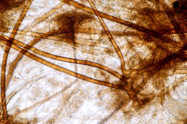  Rhizopus 'un özellikleri, eğitim için mikroskop altında kayan yaygın bir safirik mantar cinsidir..