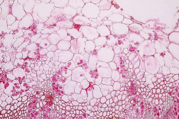 Zygomycota, or zygote fungi ,Downy mildew of cruzifers host tissue with conidia living in decaying plant on Slide under the microscope for education.