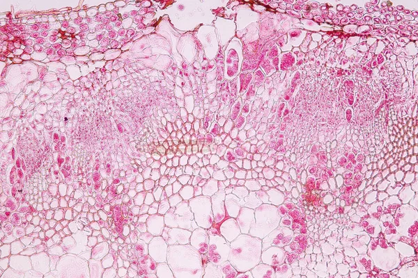 Zygomycota, or zygote fungi ,Downy mildew of cruzifers host tissue with conidia living in decaying plant on Slide under the microscope for education.